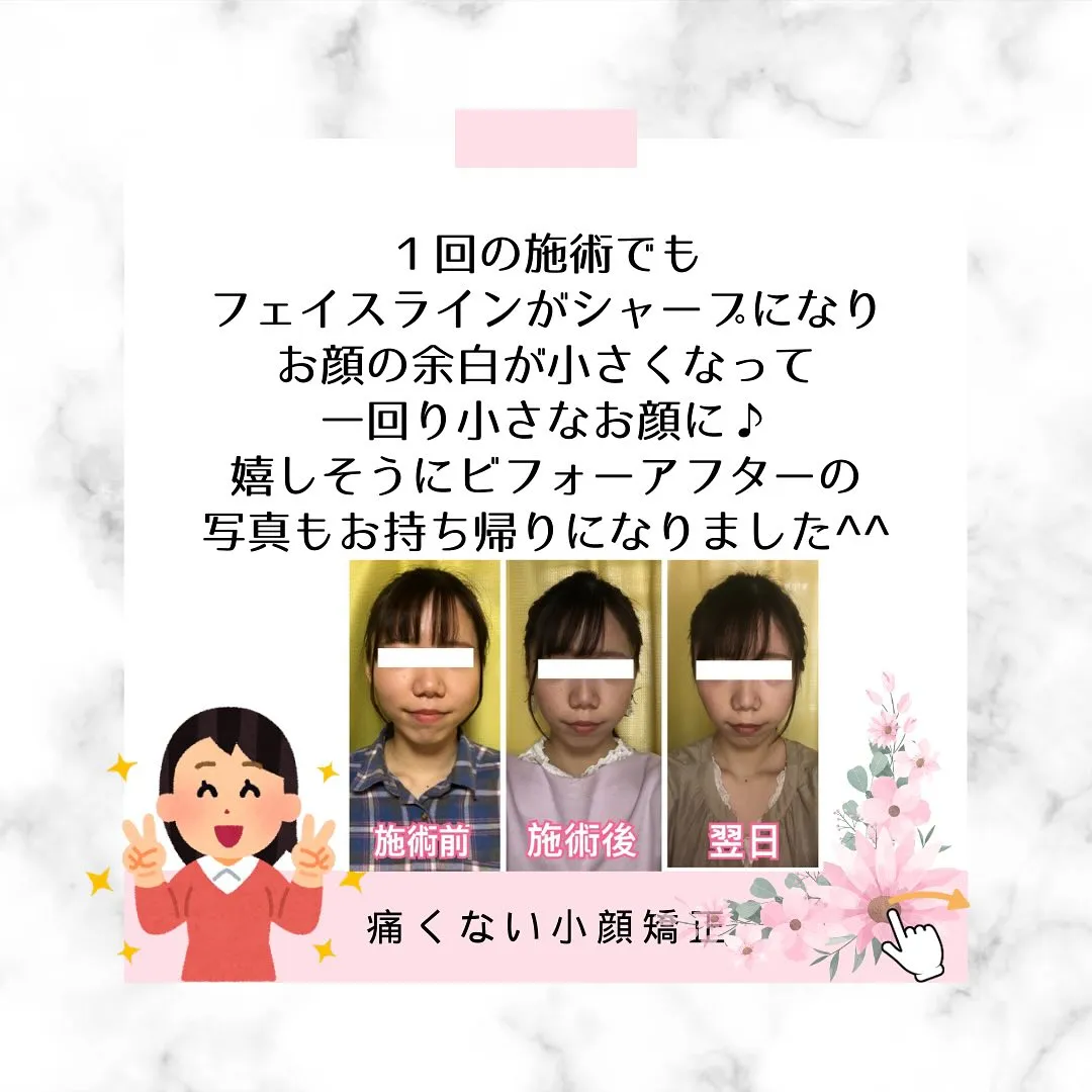 🌸学生さんも小顔矯正でコンプレックス解除！【京都市伏見区小顔...