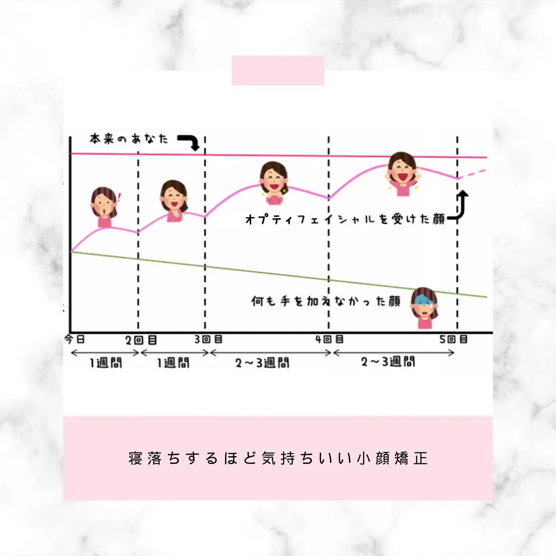 🌸✨若々しい小顔をキープできるお勧めの施術間隔✨【京都市伏見...