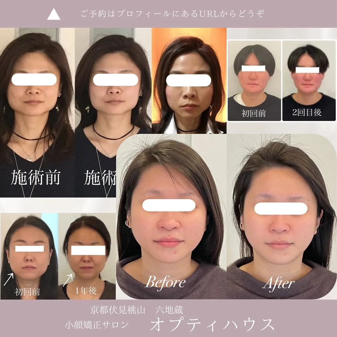 📌エラ張りを成長させないセルフケア🦷💆‍♀️