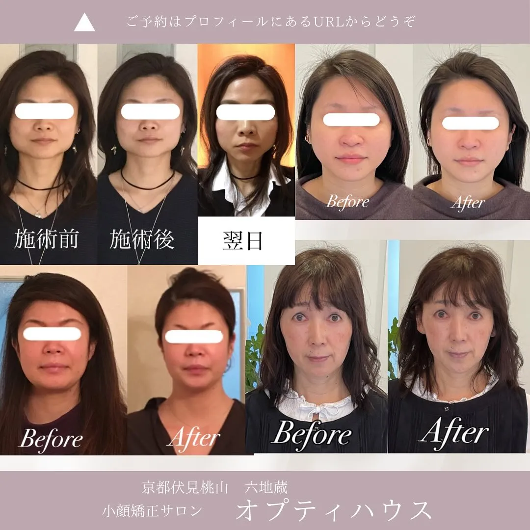 📣その習慣、小顔を遠ざけてるかも…？！