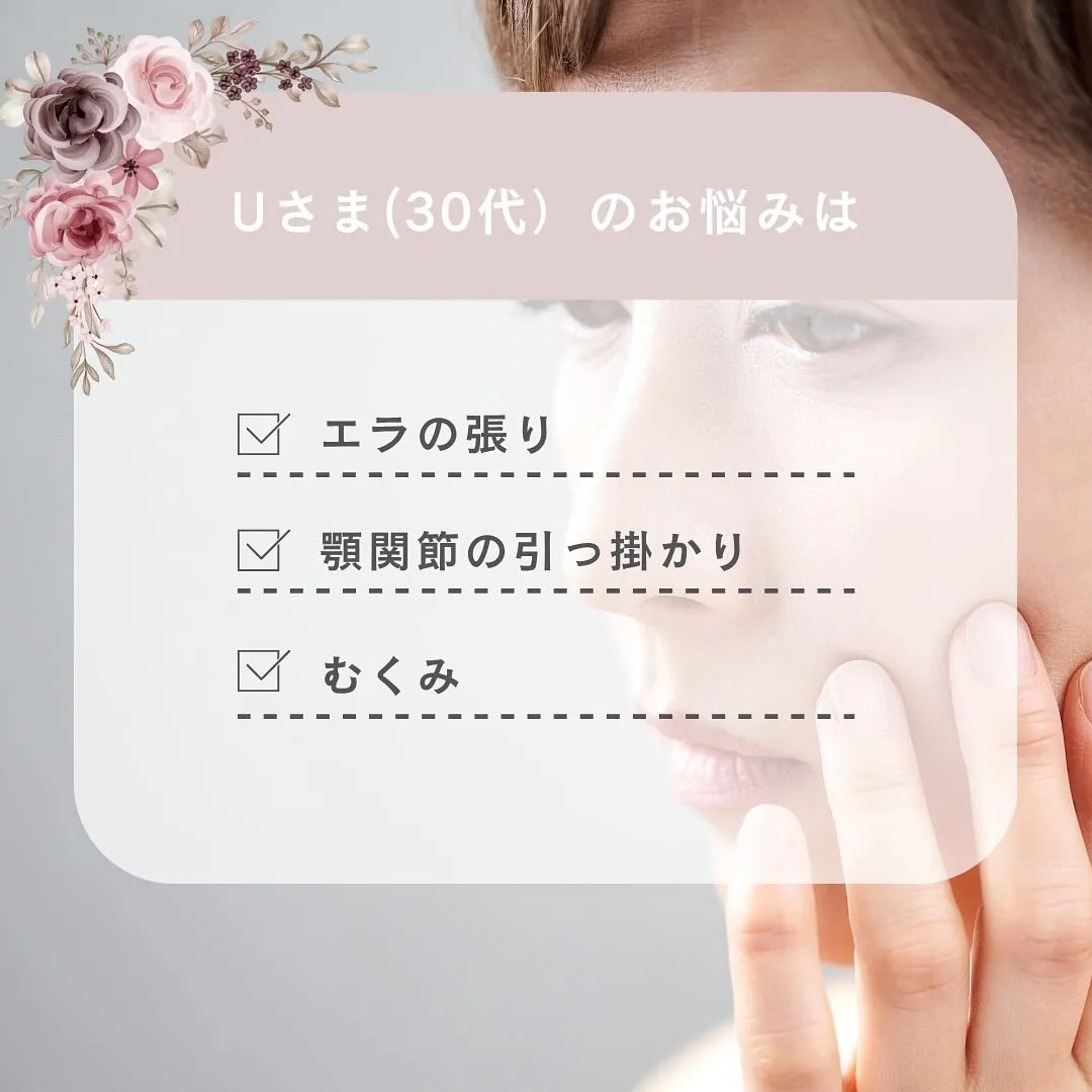 【京都 小顔矯正】💆‍♀️エラ張り・たるみ・むくみ…気になる...