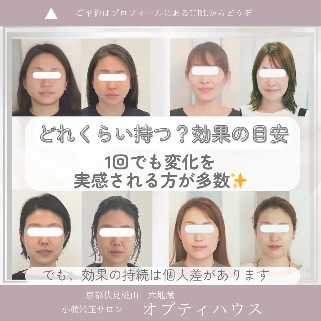 【小顔矯正って、どれくらいもつの？】 
