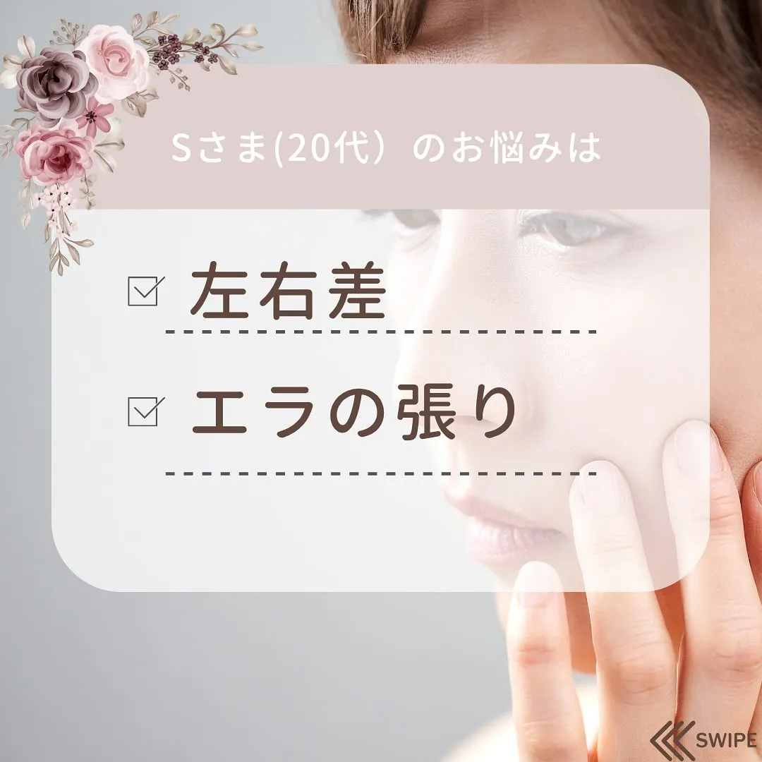 📢 大切なイベント前に小顔矯正 💖京都伏見