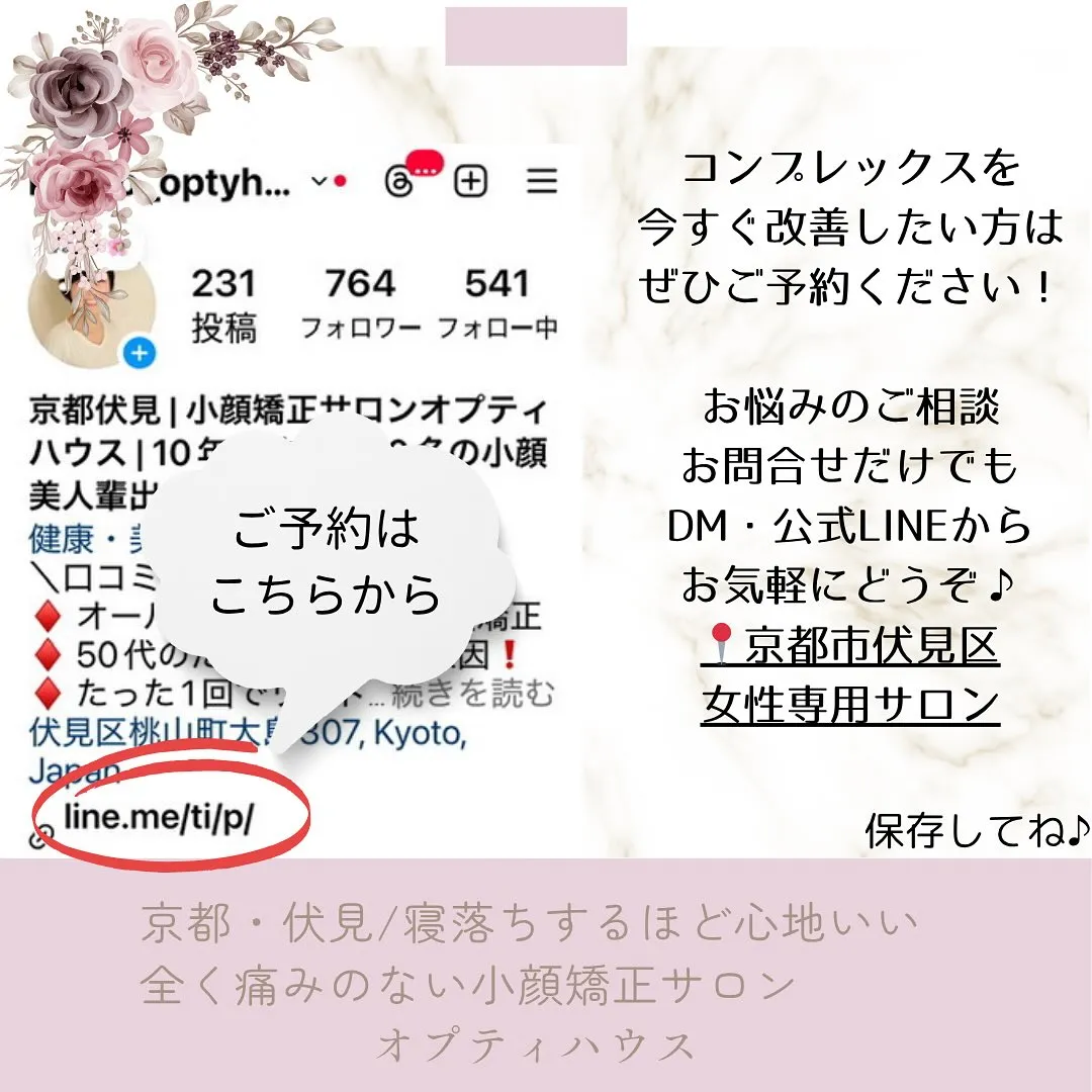 📢 大切なイベント前に小顔矯正 💖京都伏見