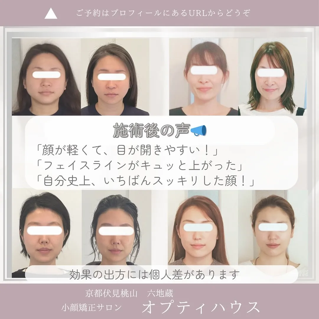 ☀️夏のむくみ、放っておかないで！【京都・小顔矯正】