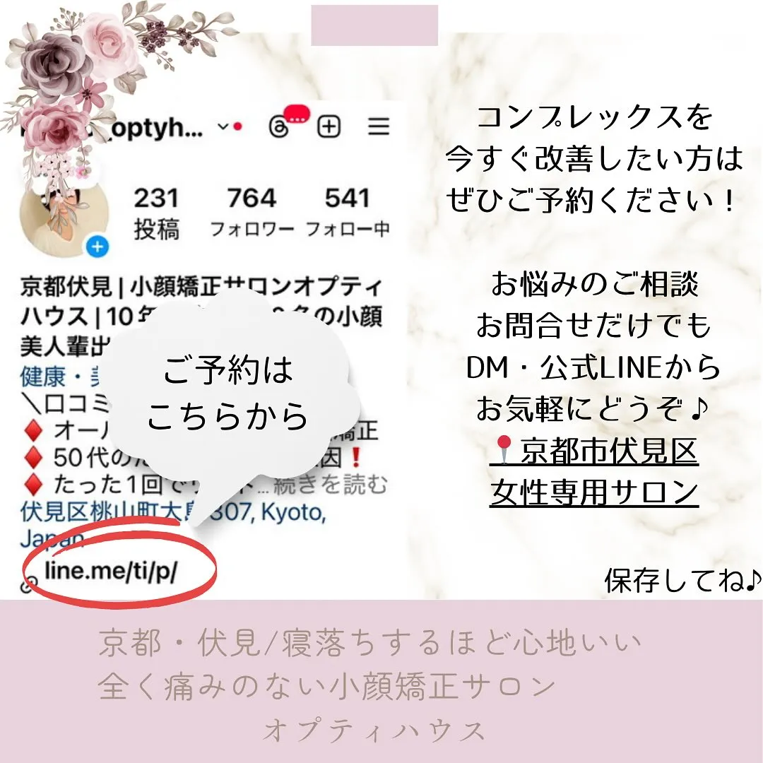 🌸 頬骨・エラ張り改善【京都市伏見区小顔矯正】💆‍♀️✨