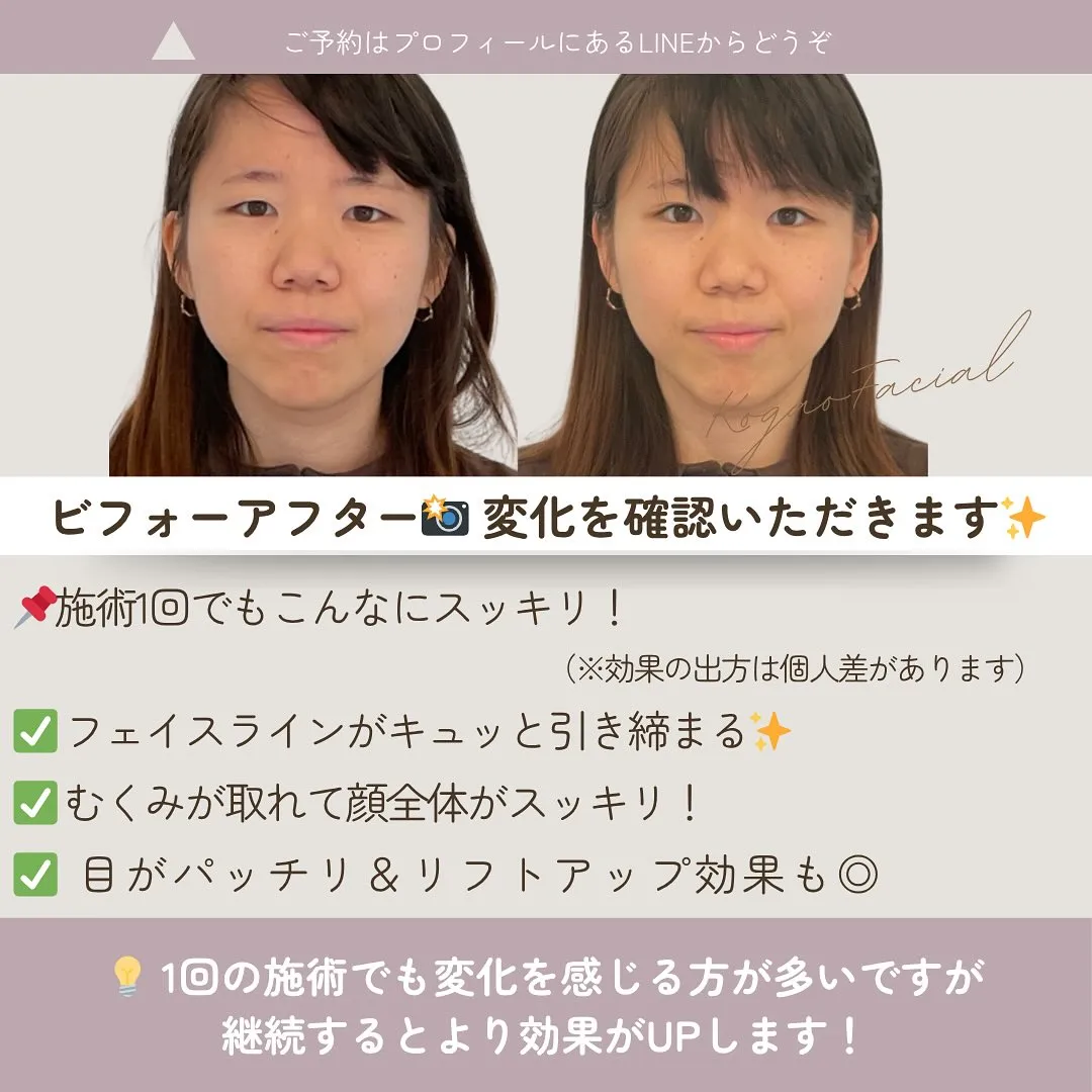 📌 「施術の流れってどんな感じ？初めての方へ