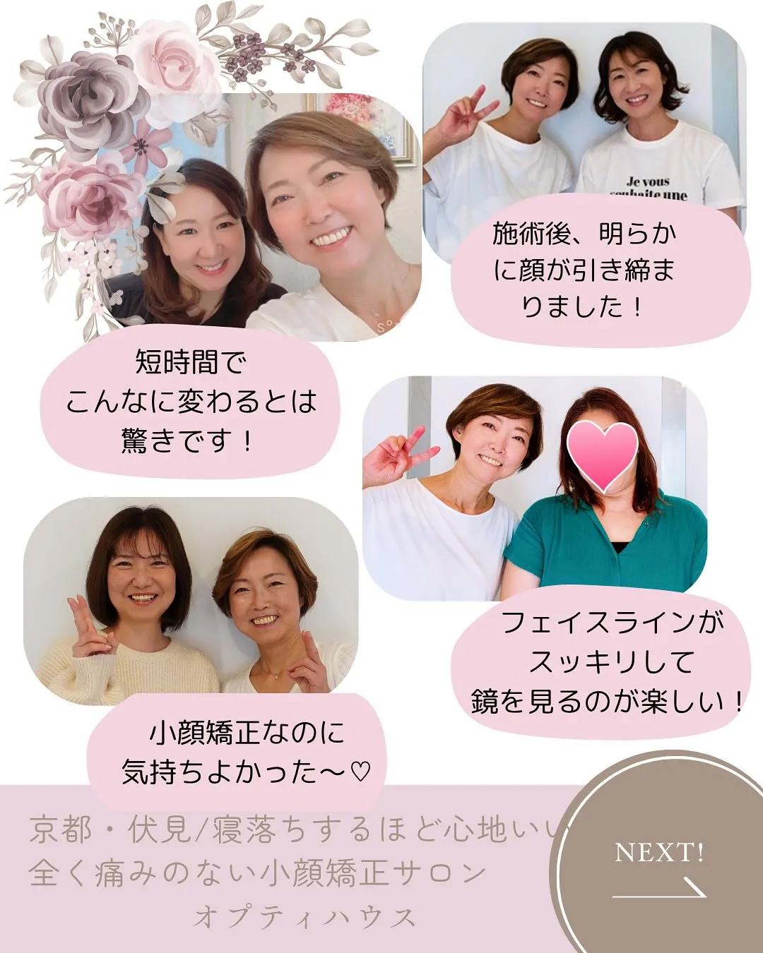 ✨ここまで変化！エラ張り改善✨