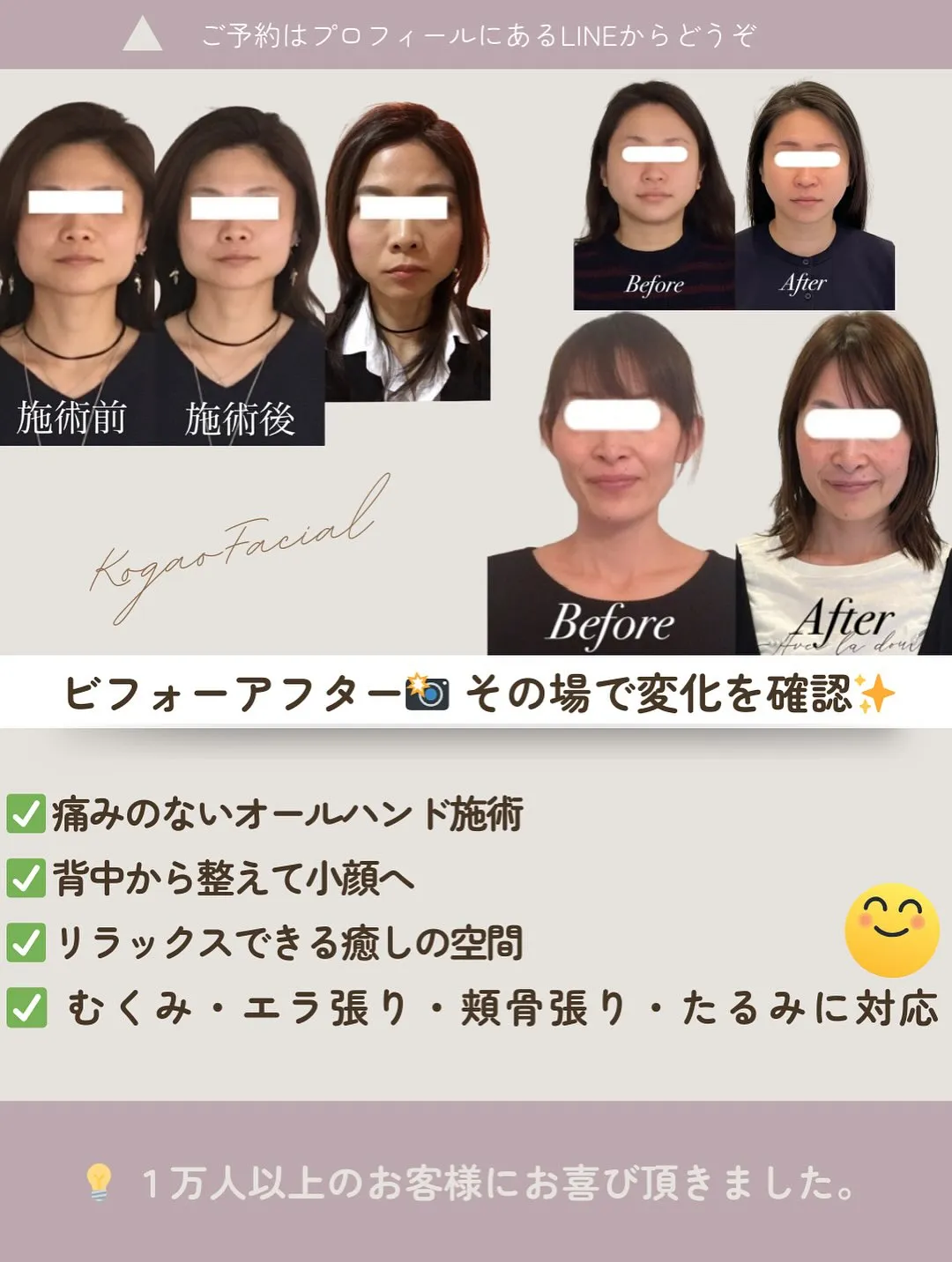 【京都 小顔矯正】🌟その場で変化を実感！お客様の声🌟