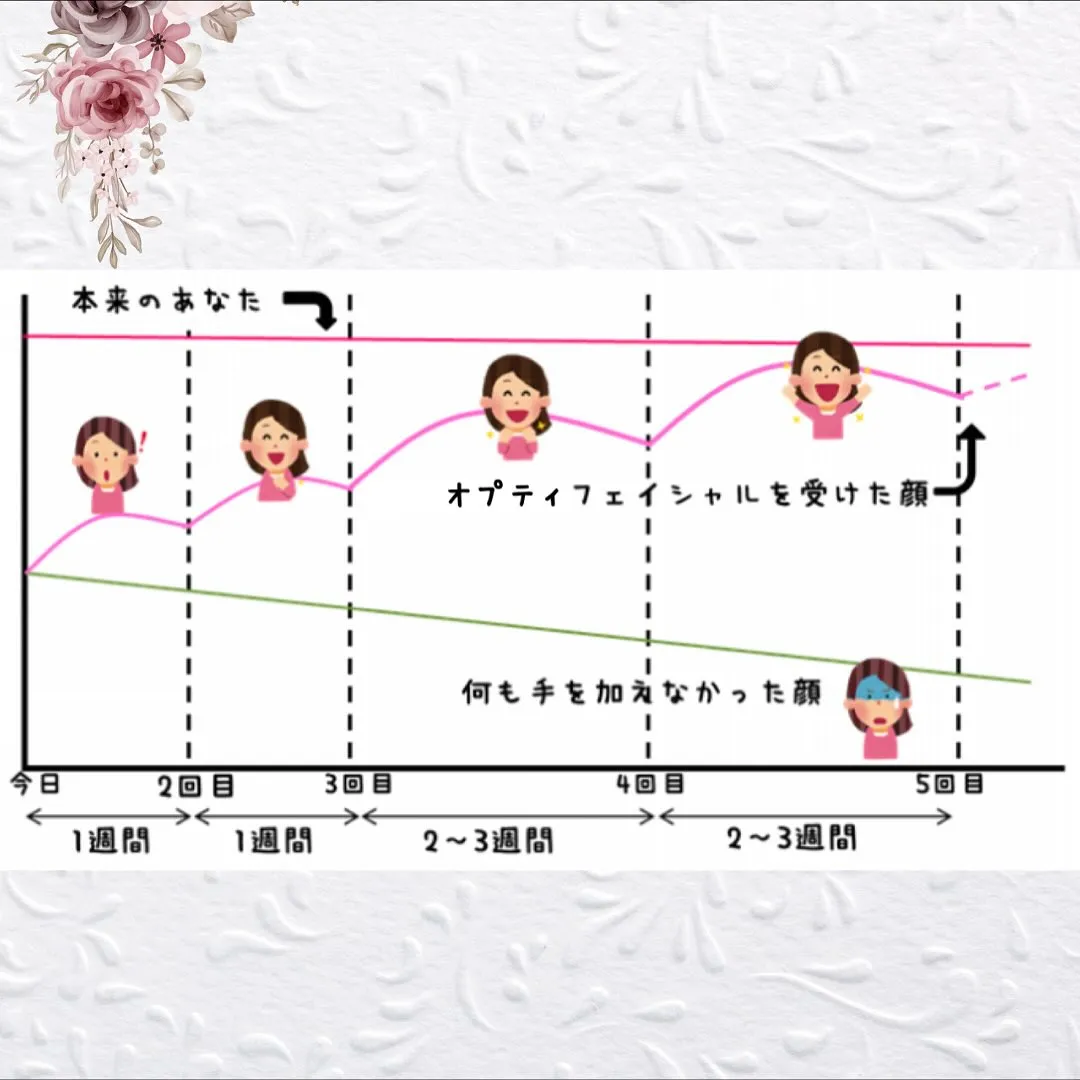 🌟【京都 小顔矯正】一番綺麗になる最適な施術間隔🌟