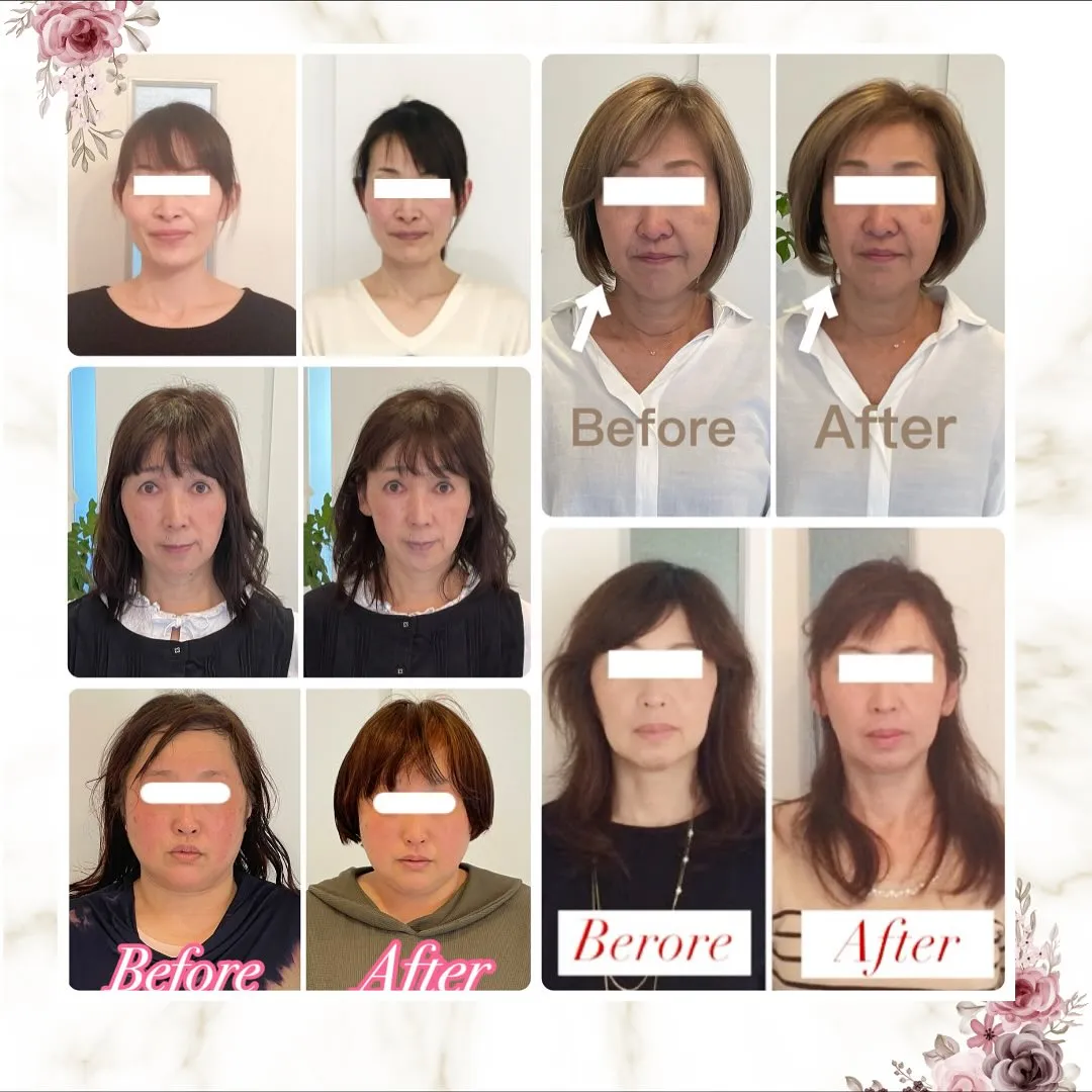 🌟【京都 小顔矯正】一番綺麗になる最適な施術間隔🌟