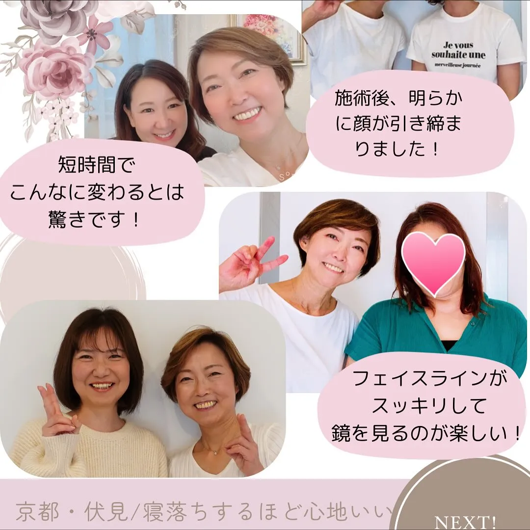 🌟【京都 小顔矯正】一番綺麗になる最適な施術間隔🌟