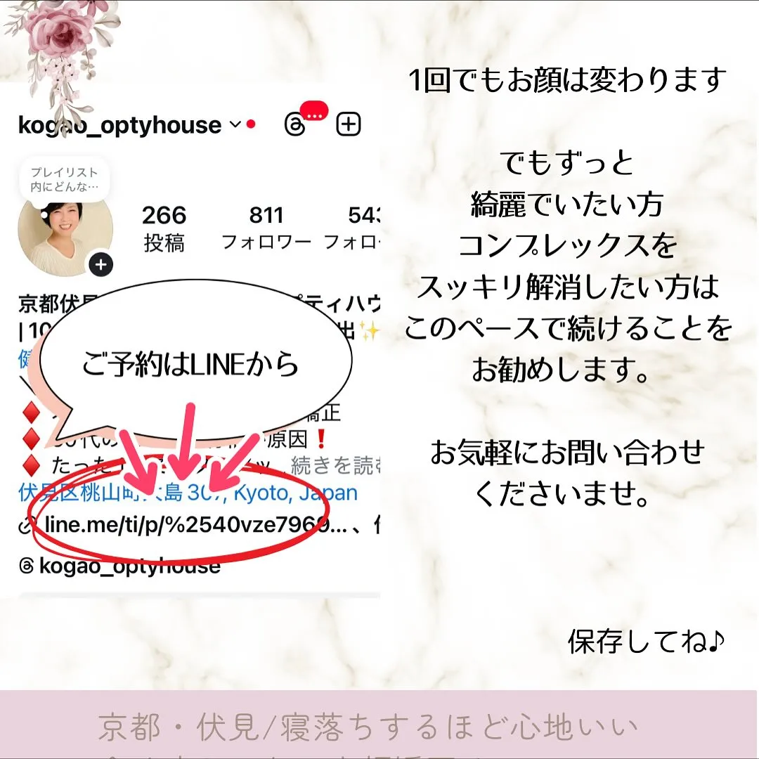 🌟【京都 小顔矯正】一番綺麗になる最適な施術間隔🌟