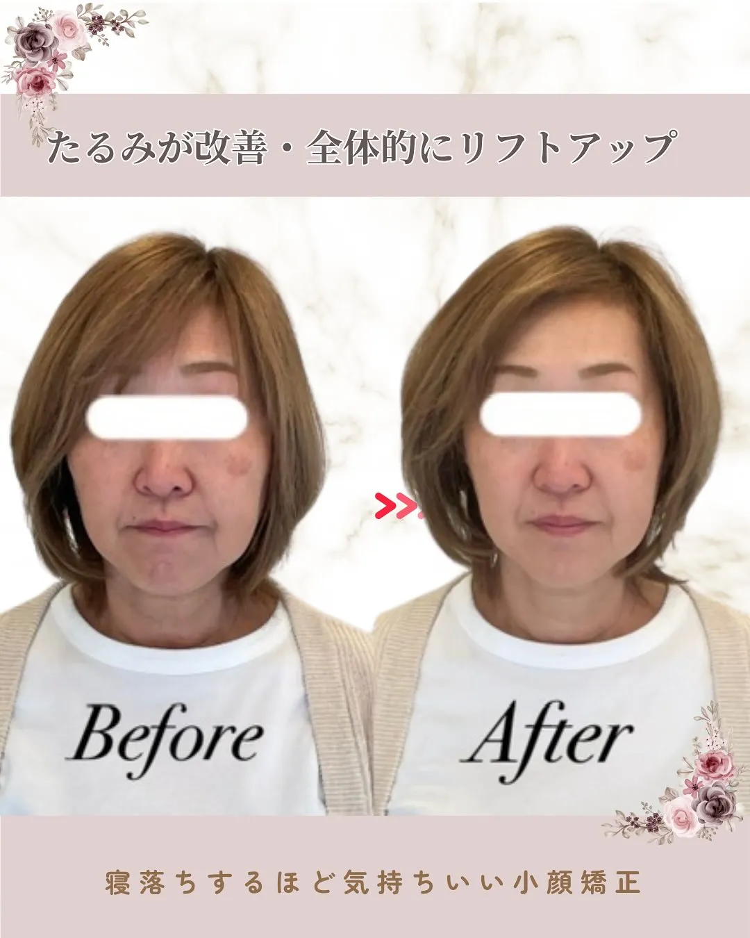 ✨＼10年来の大切なお客様のビフォーアフター／✨