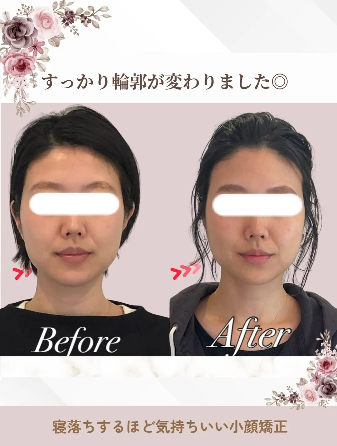 💡 鏡を見るたびに「なんか顔が歪んでる気がする…」と感じたこ...