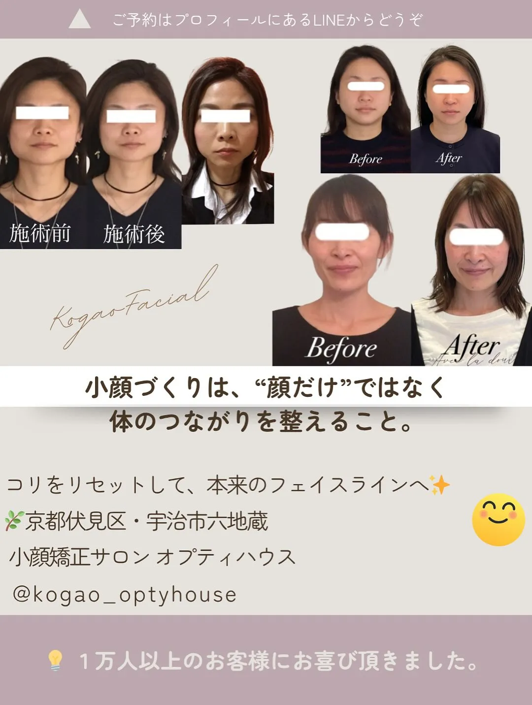 💡「顔だけほぐしても、戻ってしまうんです…💭」 