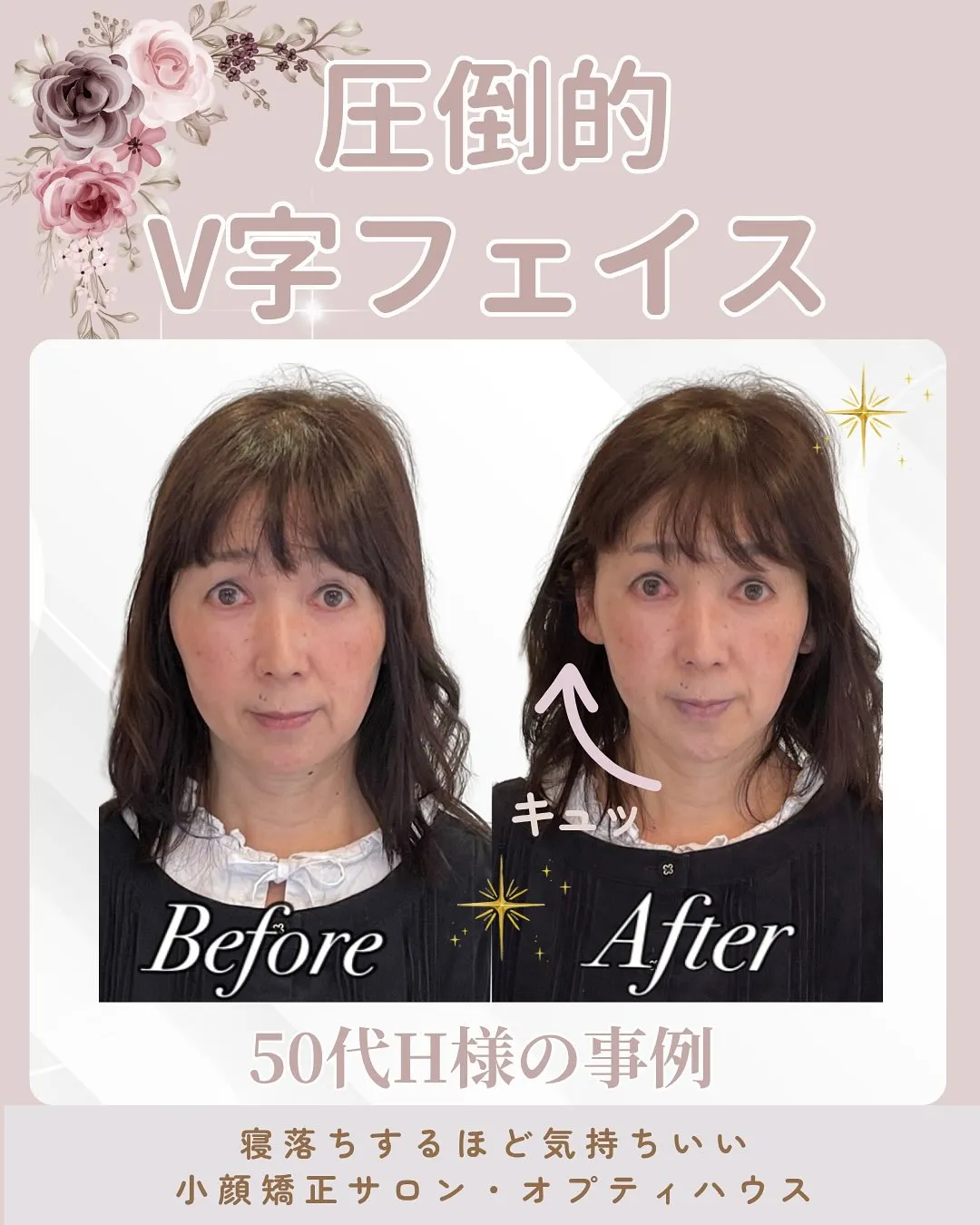 📢【劇的！V字フェイス✨】