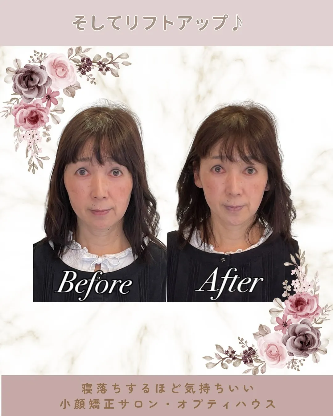 📢【劇的！V字フェイス✨】