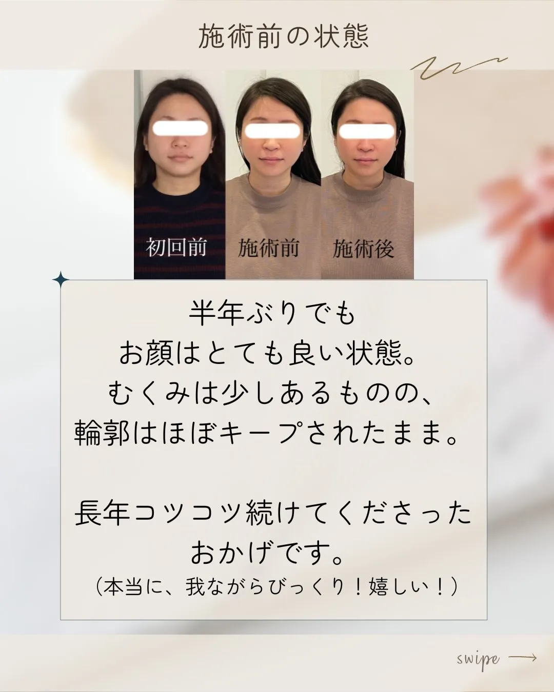 🌸✨半年ぶりのご来店✨🌸【京都市伏見区・小顔矯正】