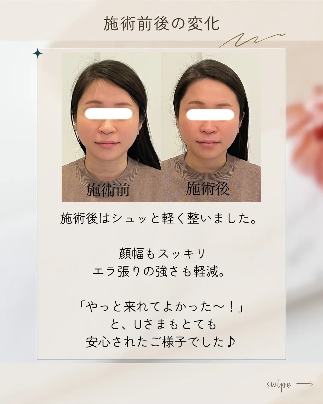 🌸✨半年ぶりのご来店✨🌸【京都市伏見区・小顔矯正】