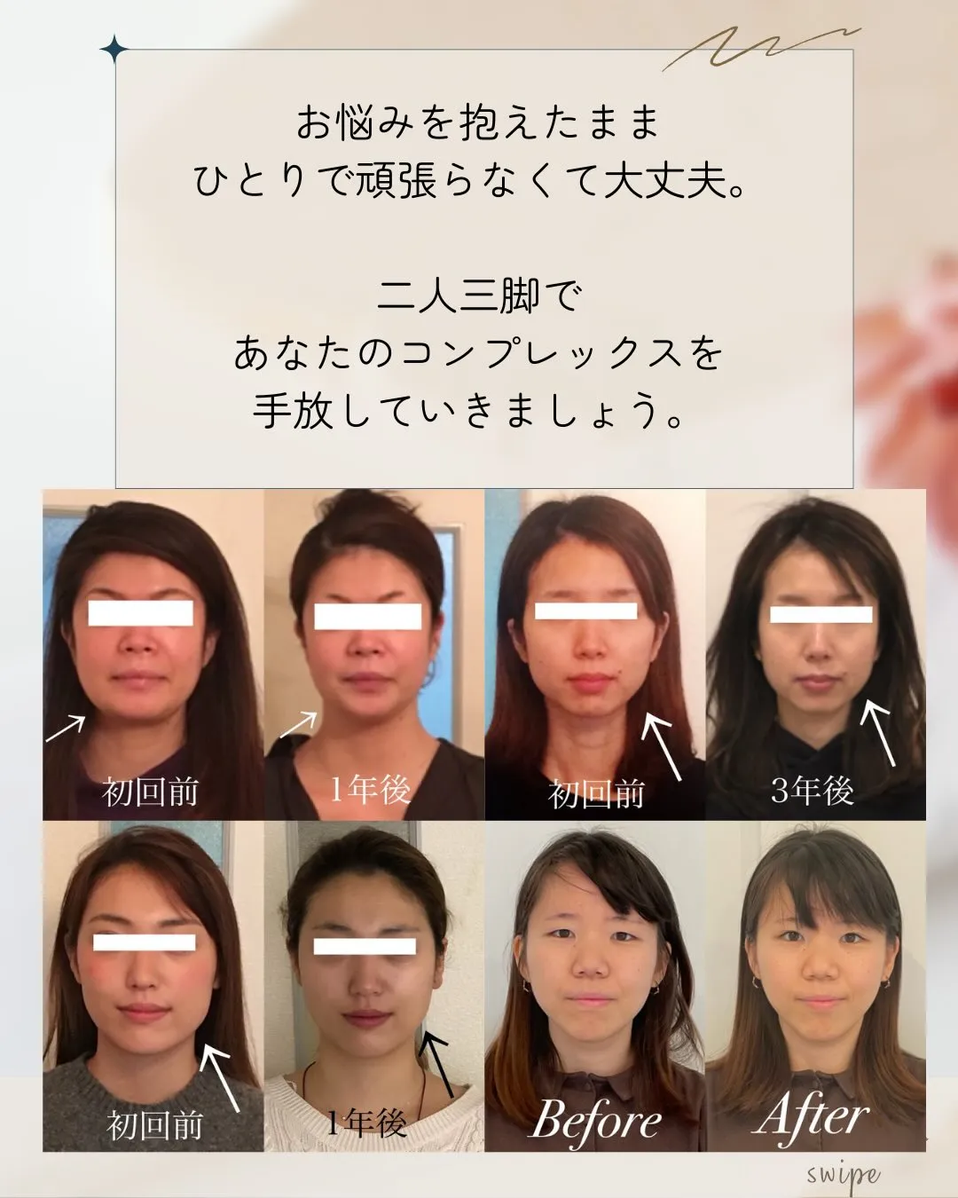 🌸✨半年ぶりのご来店✨🌸【京都市伏見区・小顔矯正】