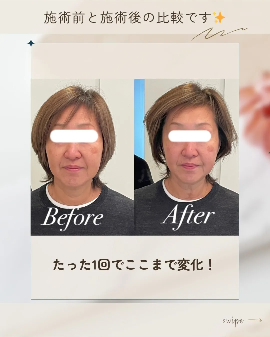 🌿✨60代でもここまで変わる！【京都市伏見区】