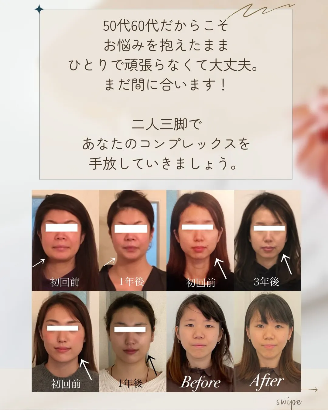 🌸 頬骨・エラ張り改善【京都市伏見区小顔矯正】💆♀️✨