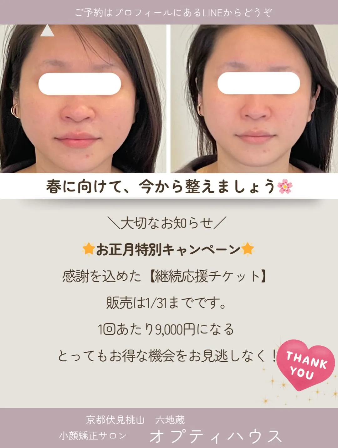 🌸 冬に顔が大きくなる理由とキャンペーンのお知らせ【京都市伏...