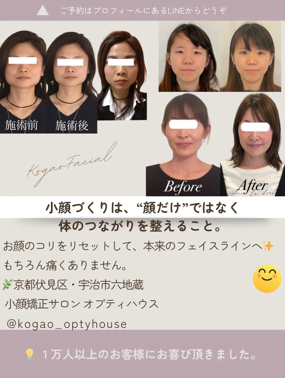 🌸 冬に顔が大きくなる理由とキャンペーンのお知らせ【京都市伏...