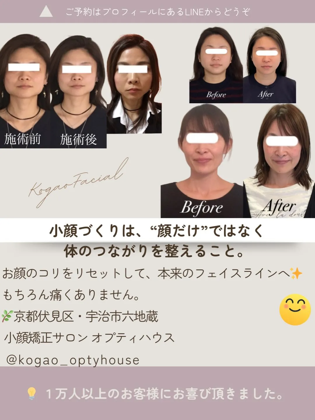 「あれ、顔が四角くなった？」鏡を見てハッとしたあなたへ😱✨【...