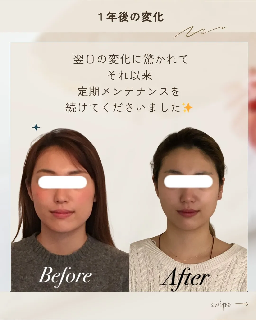 左右差や歪み、諦めていませんか？😭1年後の変化に驚きです✨【...