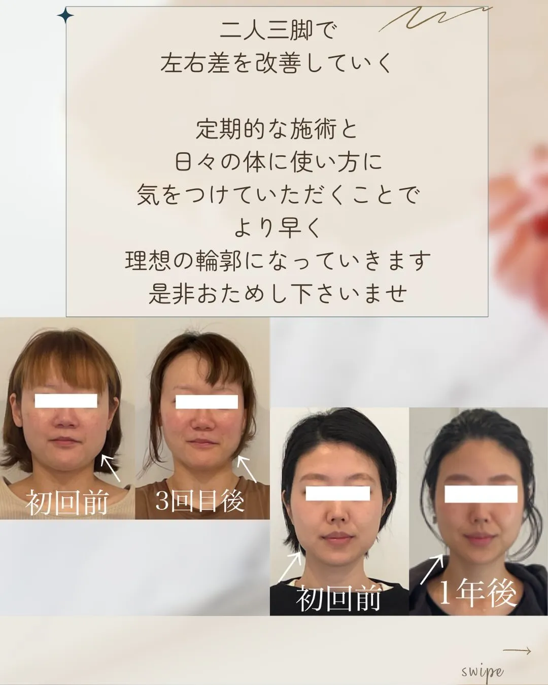 左右差や歪み、諦めていませんか？😭1年後の変化に驚きです✨【...