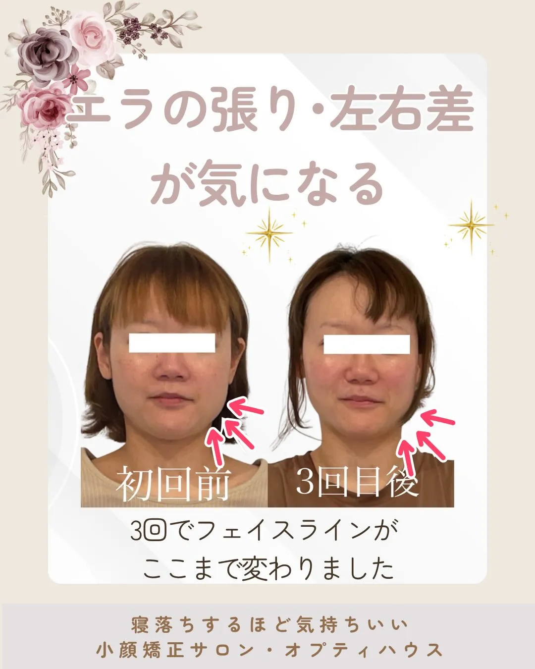 ✨「本当に顔の形って変わるんですか?」🌸 京都伏見小顔矯正