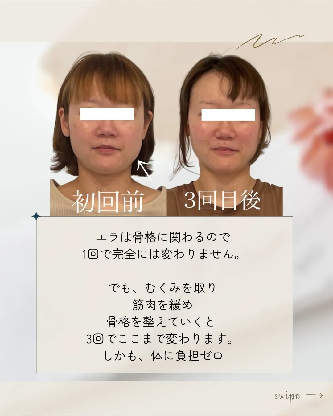 ✨「本当に顔の形って変わるんですか?」🌸 京都伏見小顔矯正