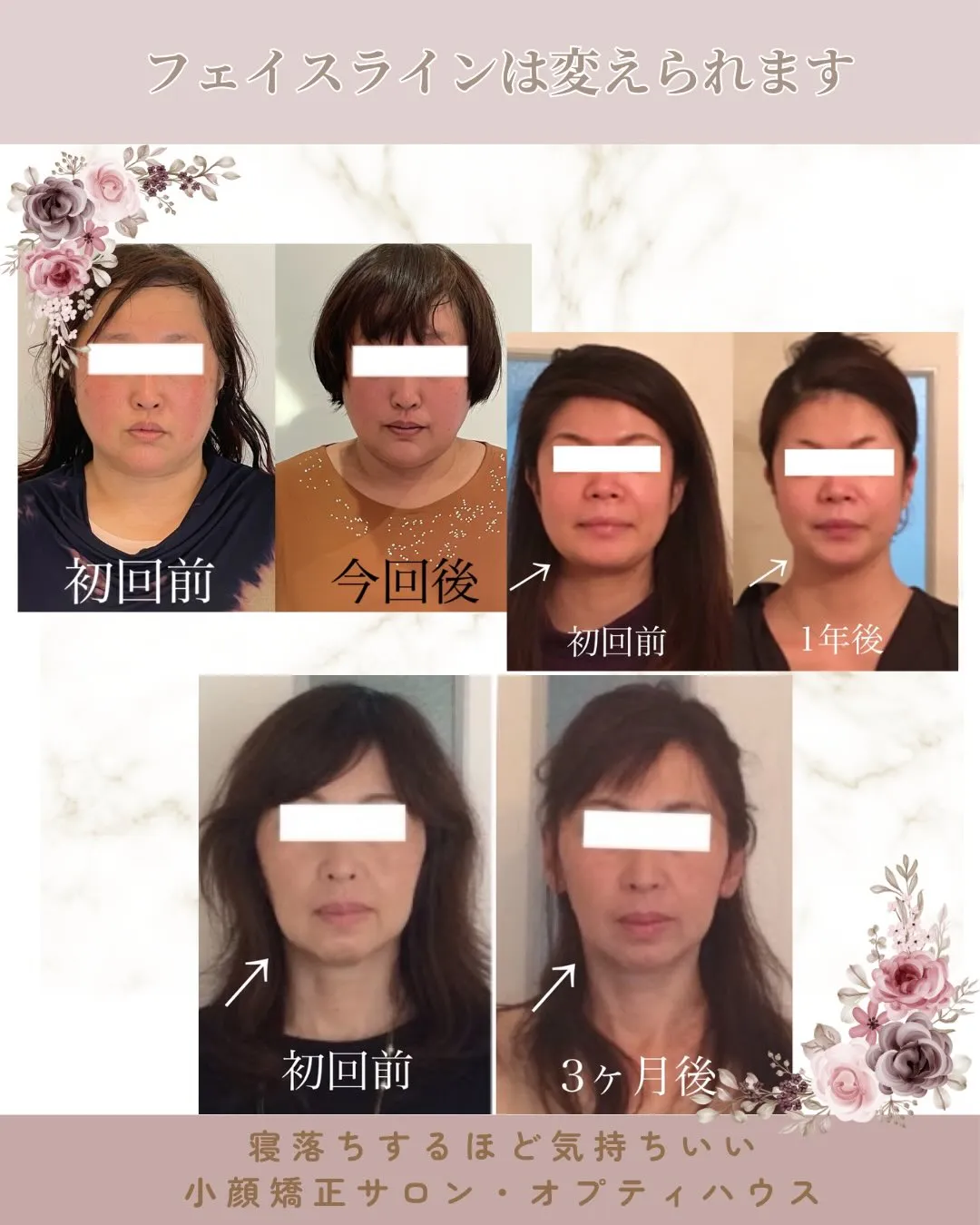 ✨📢【圧倒的V字フェイス✨】1回でここまで変わります🌸 京都...