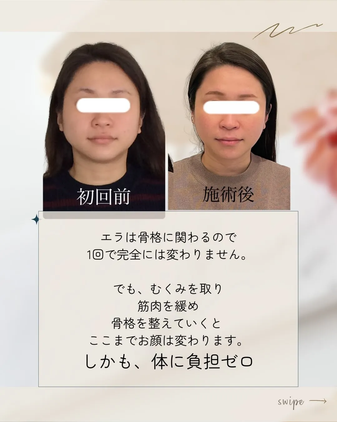 【京都 小顔矯正】💆‍♀️エラ張り・たるみ・むくみ…気になる...