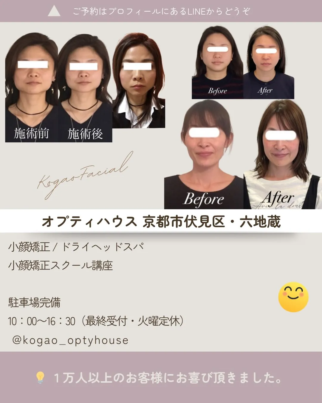 ✨【京都市小顔矯正】当サロンが選ばれる理由🌸 13年間・延べ...