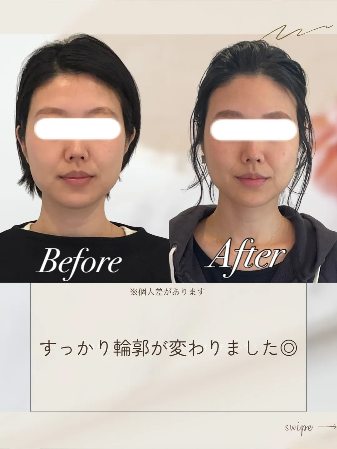 ✨【京都市小顔矯正】👀 顔の左右差、骨格のせいだとあきらめて...