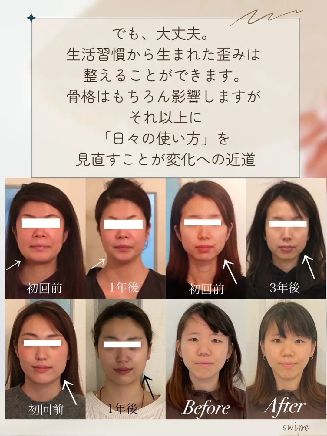 ✨【京都市小顔矯正】👀 顔の左右差、骨格のせいだとあきらめて...