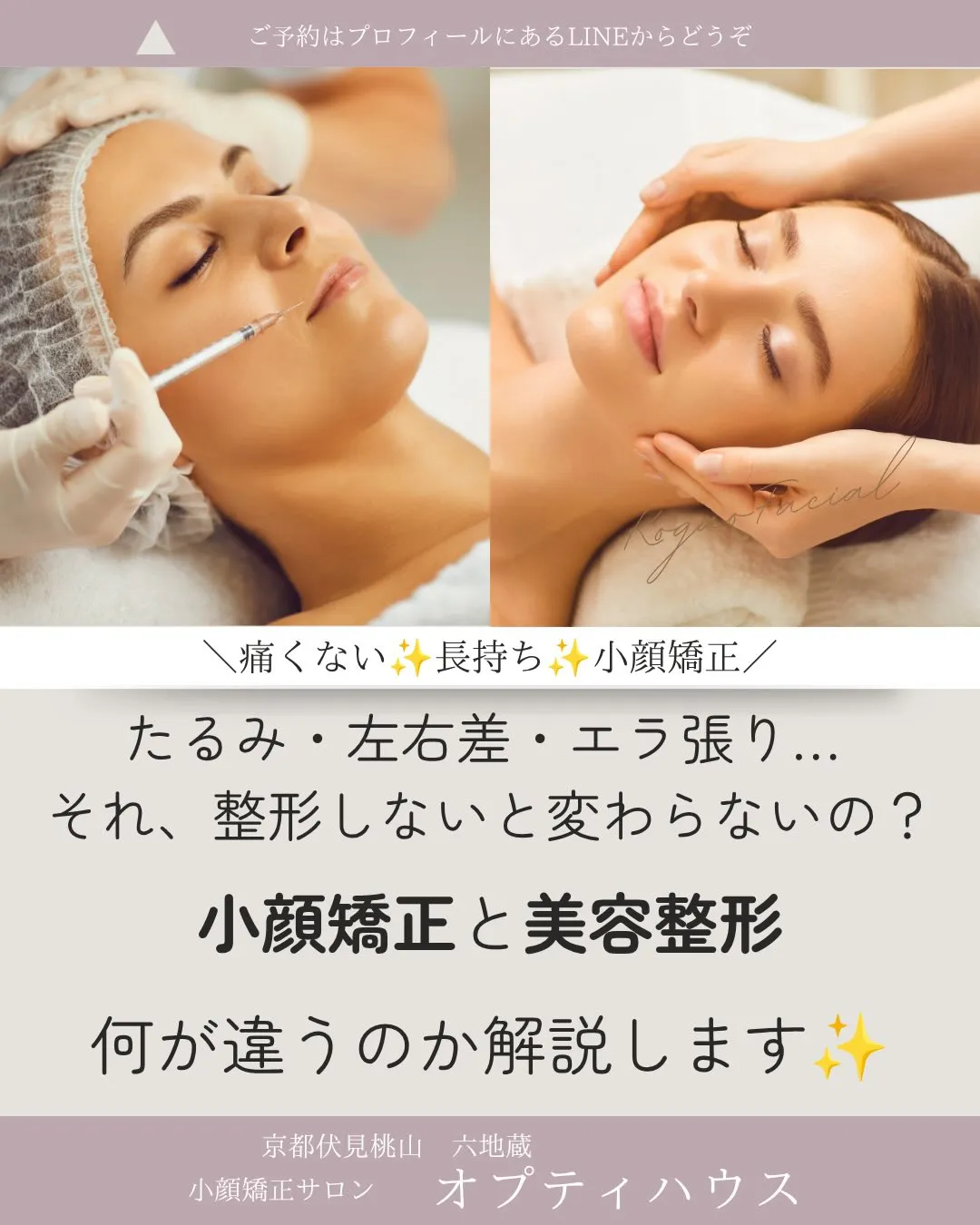 ✨【京都市小顔矯正】たるみ・左右差・エラ張り…整形しないと変...
