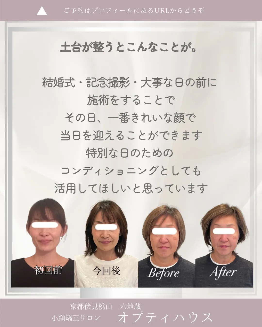 ✨【京都市小顔矯正】たるみ・左右差・エラ張り…整形しないと変...