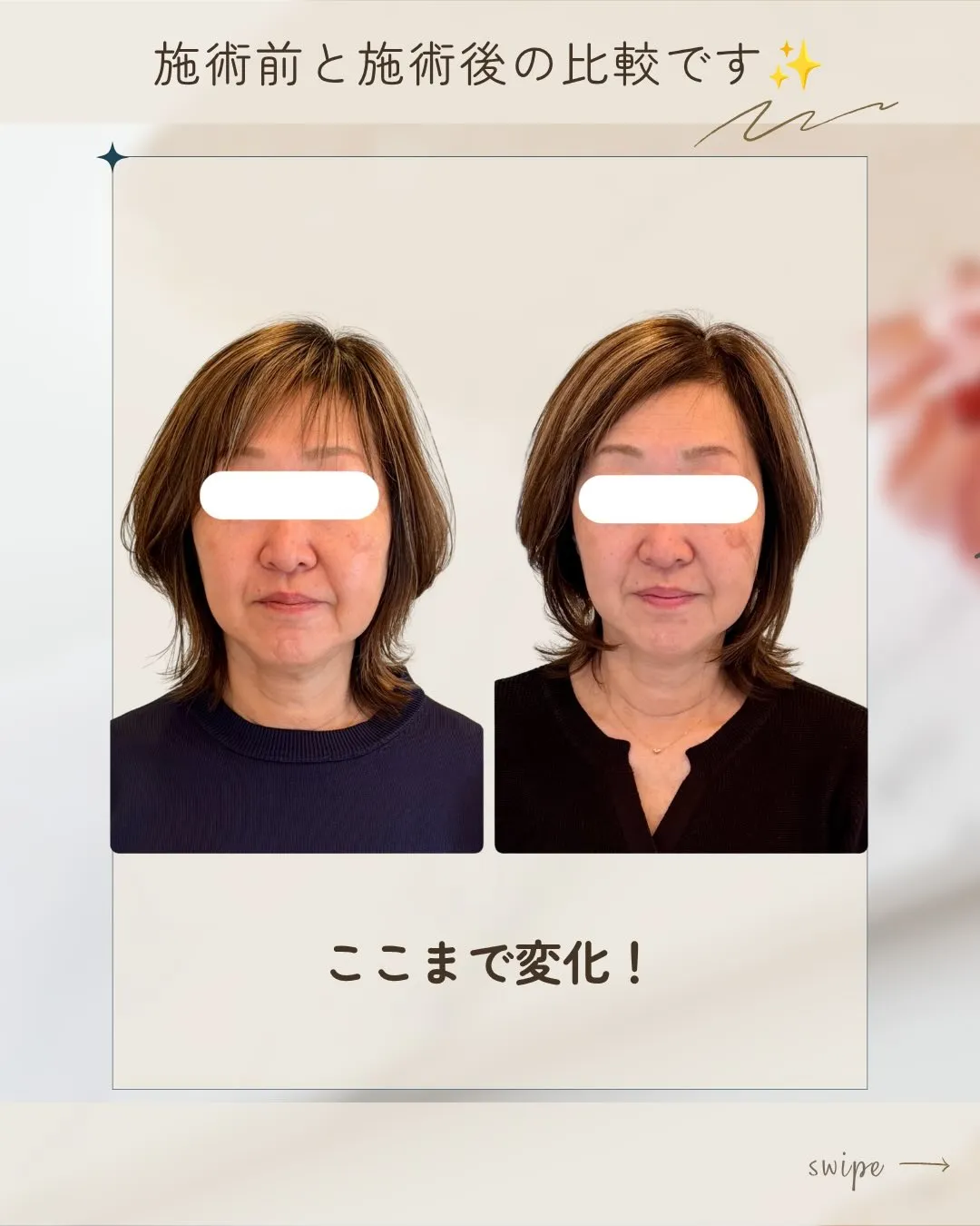 【「もう年齢的に遅いかな…」って、思ったことありませんか？】