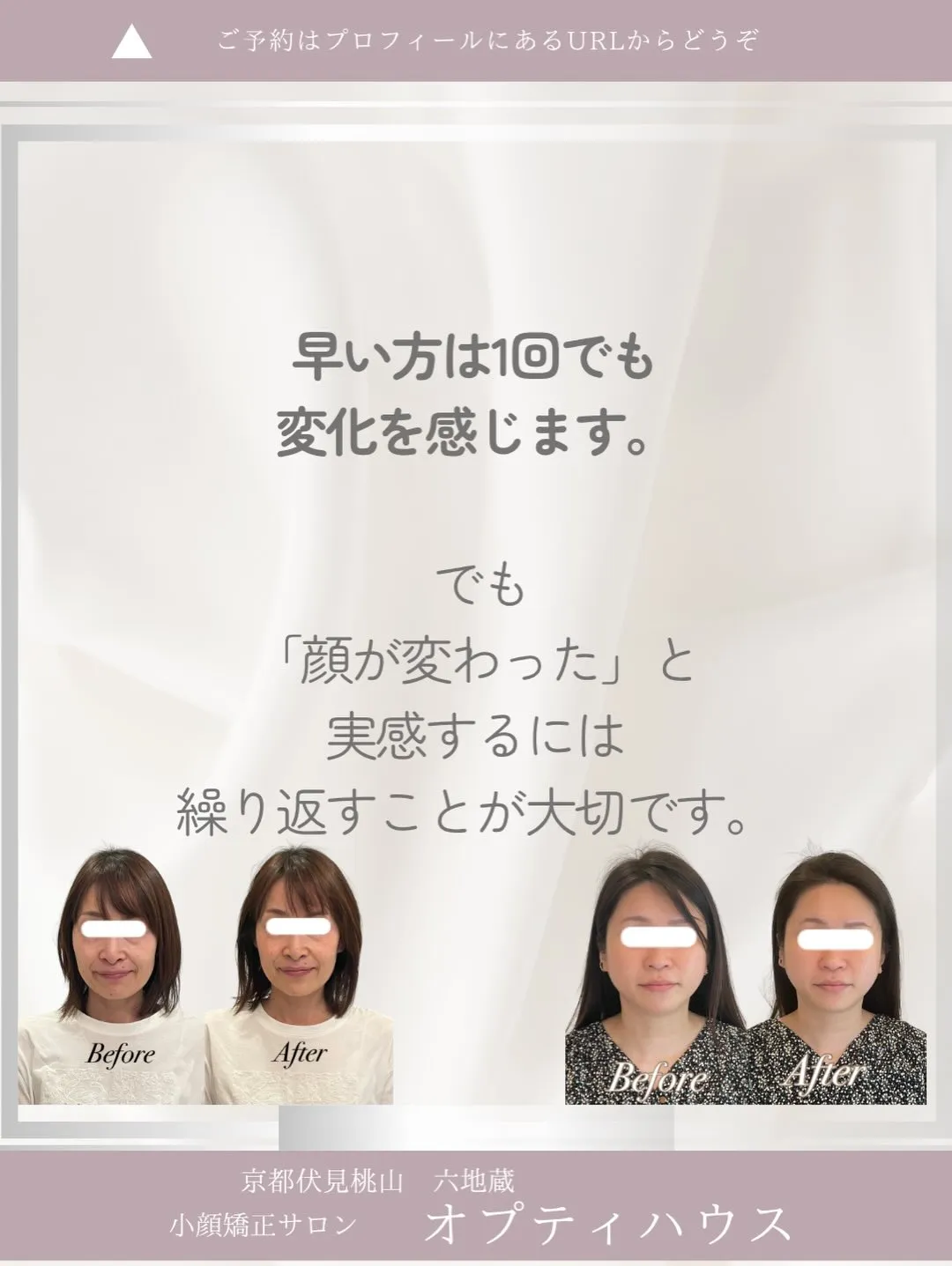 【「小顔矯正って何回で変わるの?」とよく聞かれます】