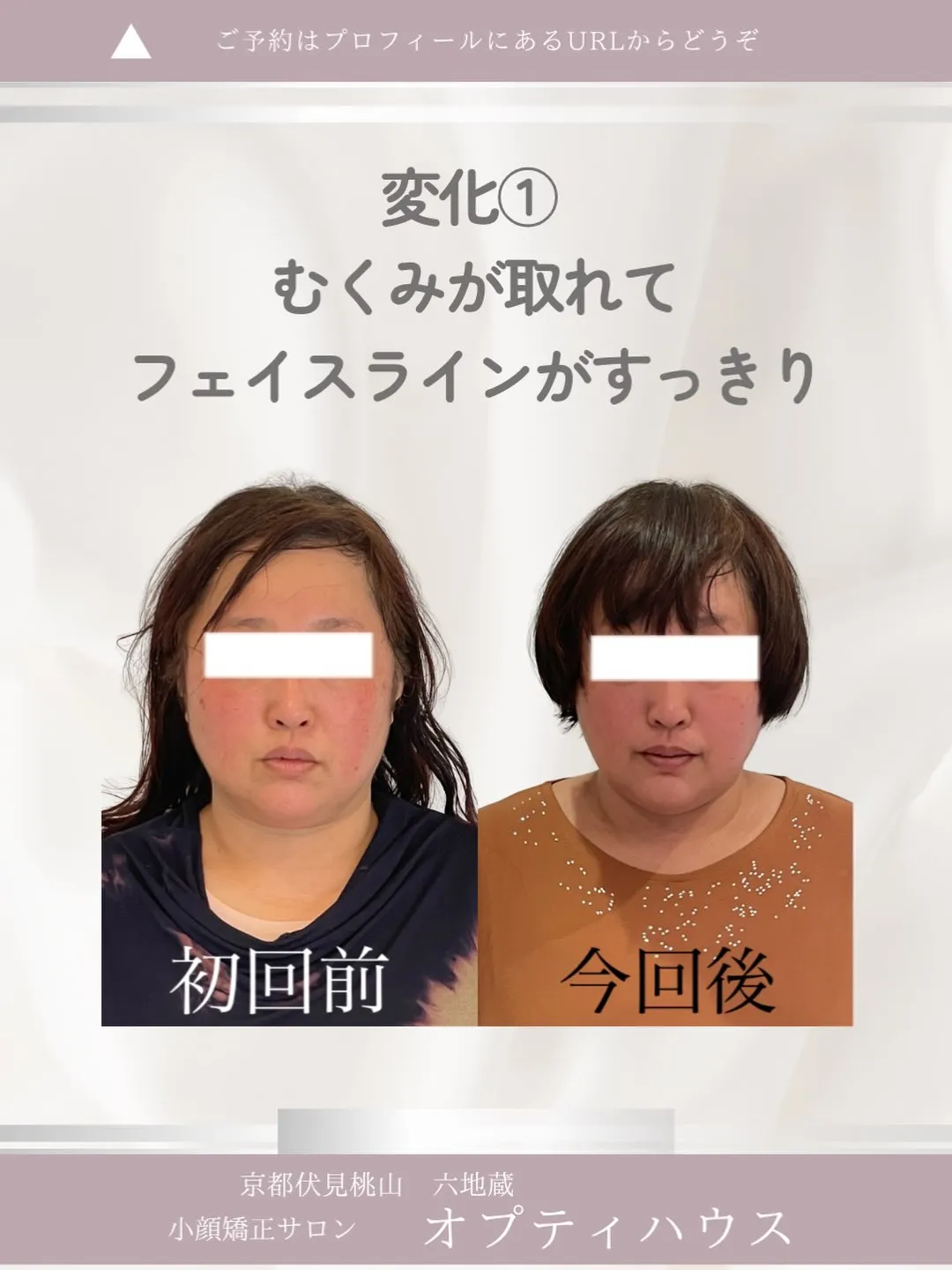 ✨【京都市小顔矯正サロン】「もう遅いかな…」そう思っていませ...