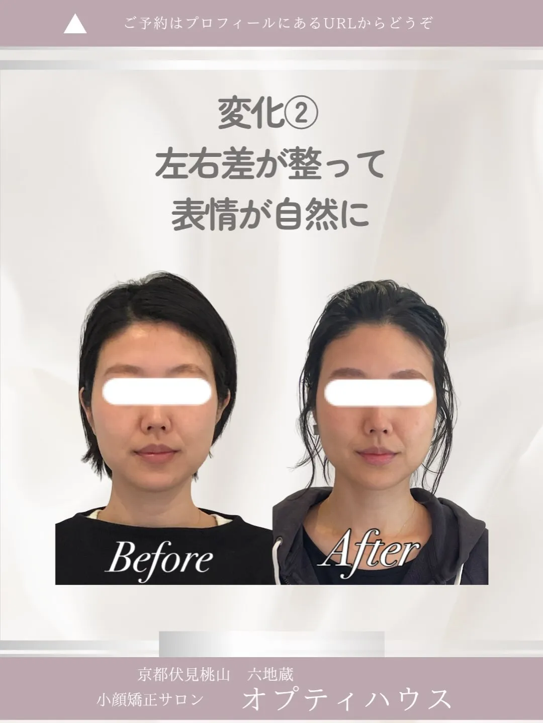 ✨【京都市小顔矯正サロン】「もう遅いかな…」そう思っていませ...