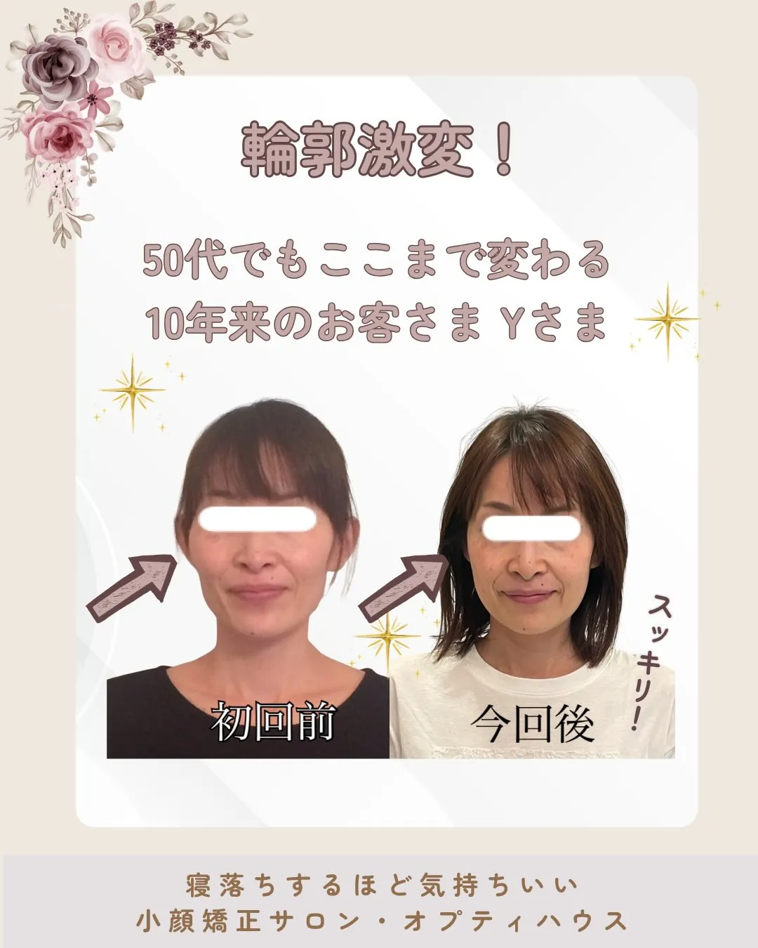 🌸 頬骨・エラ張り改善【京都市伏見区小顔矯正】💆♀️✨