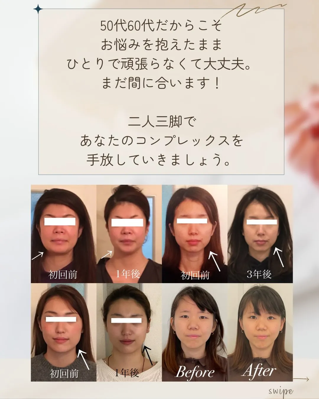 🌸 頬骨・エラ張り改善【京都市伏見区小顔矯正】💆♀️✨