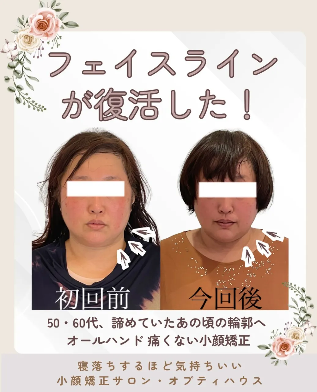 ✨50代・60代のフェイスライン悩みに|京都・伏見の痛くない...